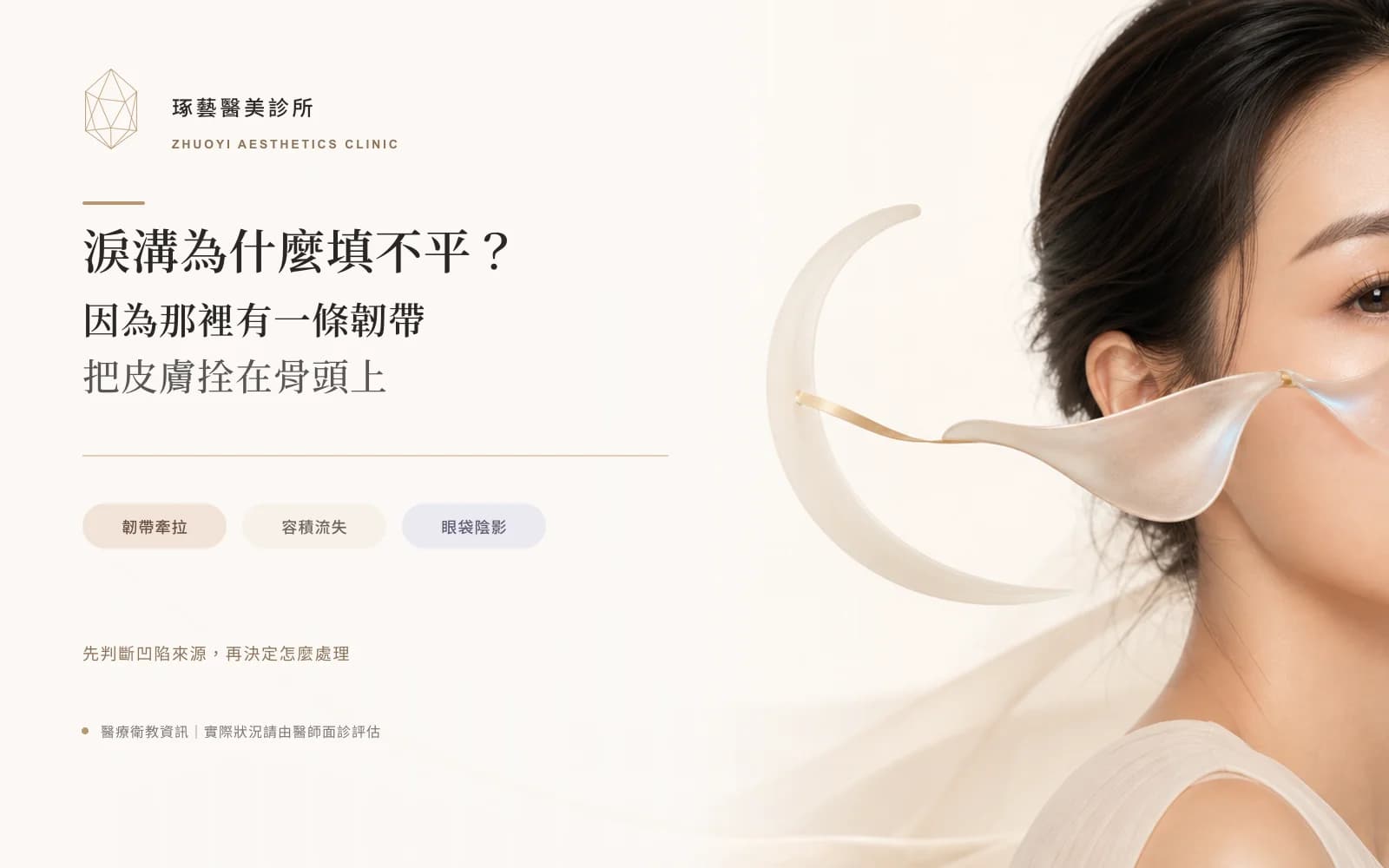 淚溝為什麼填不平?因為那裡有一條韌帶把皮膚拴在骨頭上