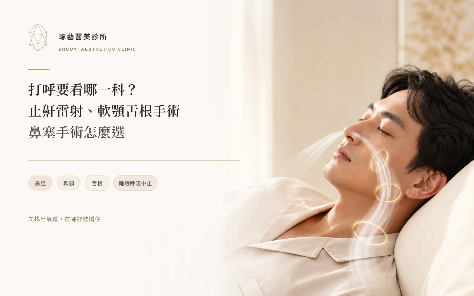 打呼要看哪一科?止鼾雷射、軟顎射頻手術與鼻塞手術怎麼選