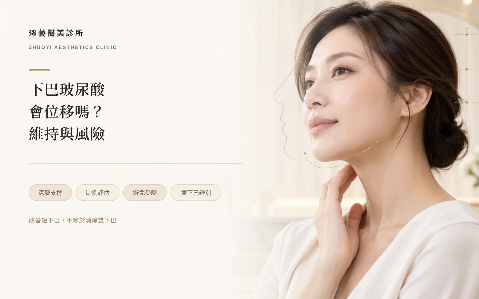 下巴玻尿酸會位移嗎?維持多久、後遺症一次看懂
