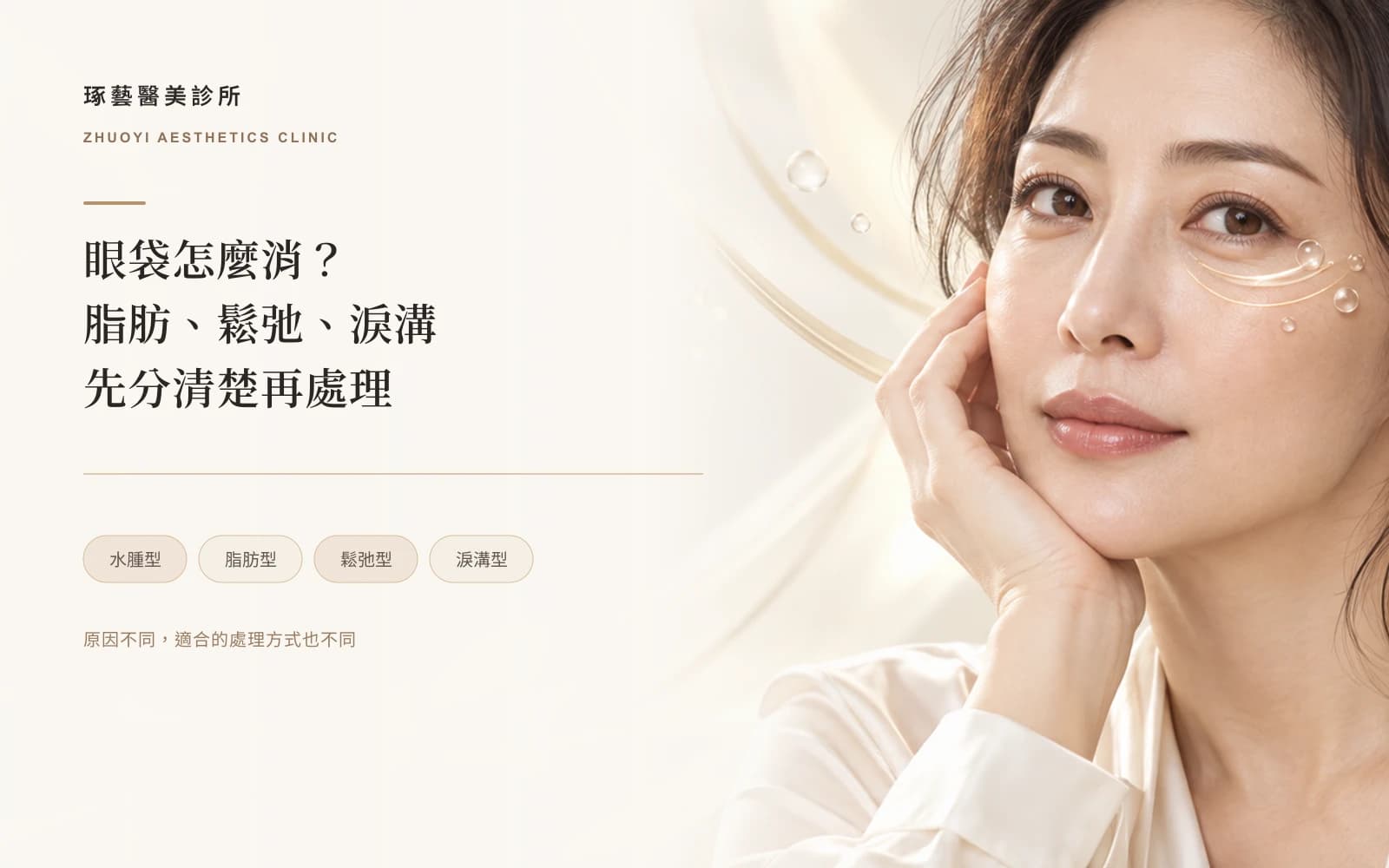 眼袋怎麼消?不開刀可以嗎?先分清楚是脂肪、鬆弛還是淚溝